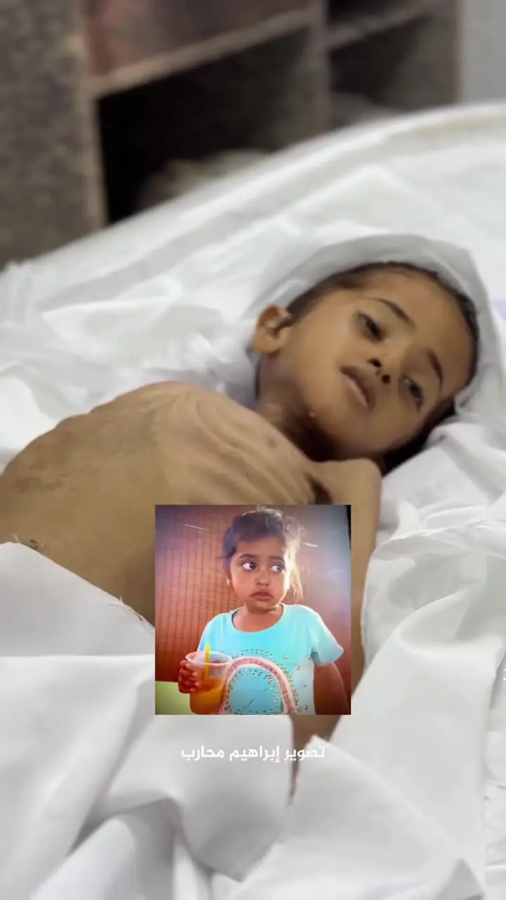 شهادت دختربچه فلسطینی بر اثر گرسنگی در غزه