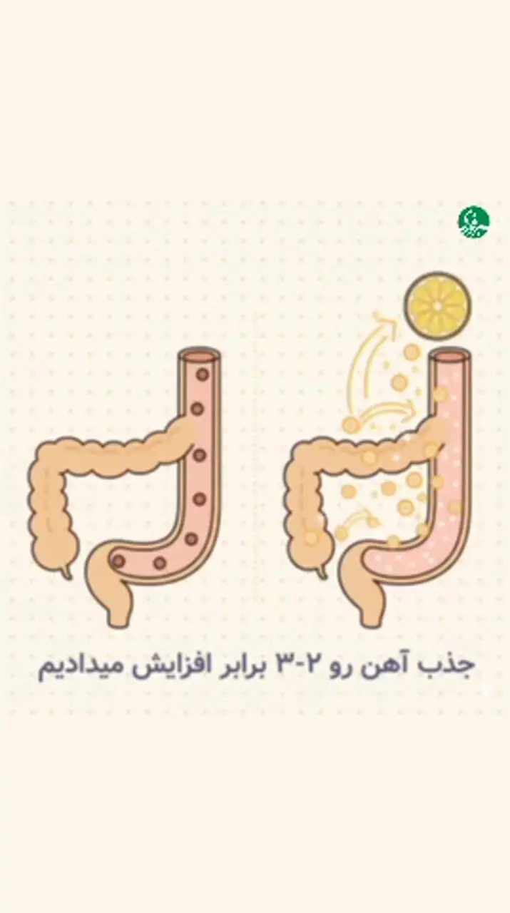 چرا کنار عدسی باید آبلیمو استفاده کنیم؟