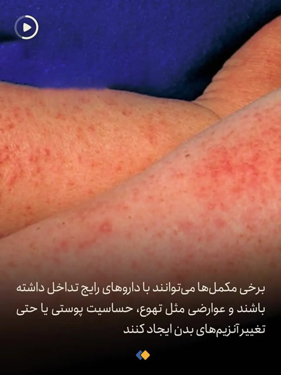 مصرف مکملها چرا و چقدر مضر است