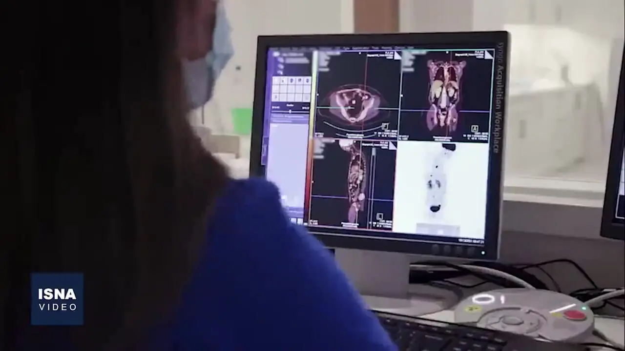 چرا موارد سرطان تیروئید در جهان رو به افزایش است؟