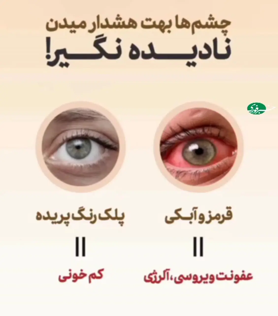 تشخیص بیماری از روی چشم ها