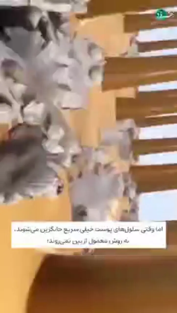 دلیل شوره سر کثیفی نیست!
