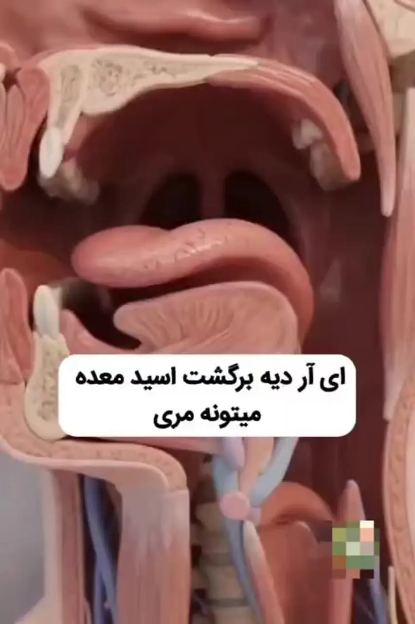 آیا می‌دانستید دلیل ریختن آب دهان روی بالش هنگام خواب چیست؟